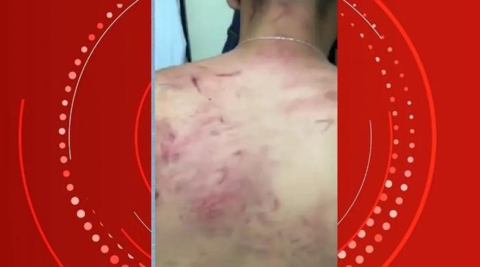 Servidor público denuncia que foi agredido e torturado por policial militar em Atalaia, AL