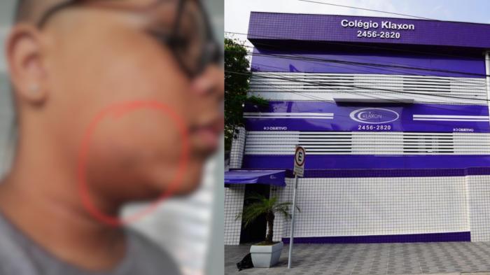 Aluno autista é agredido por colega de classe e família denuncia bullying, no interior de São Paulo